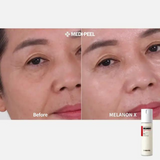 Melanon X Liposome Ampoule Mist