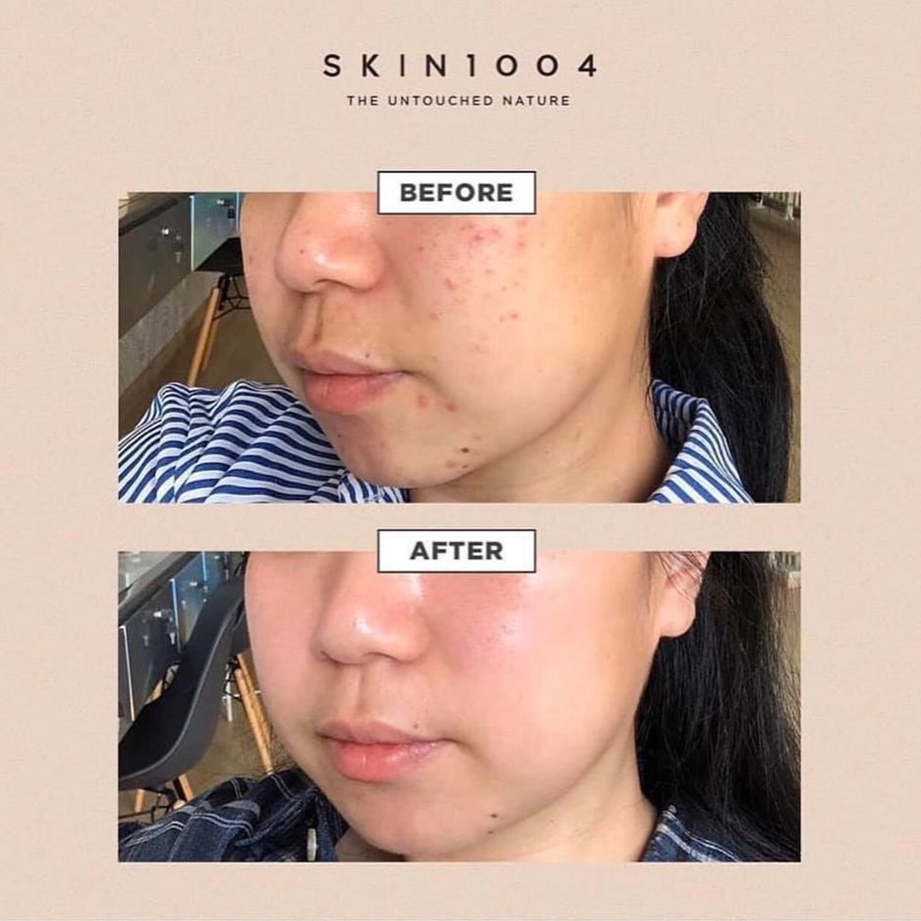 Skin1004 Madagascar Ccentella Ampoule Travel Size Beautyholics skin1004-madagascar-ccentella-ampoule-travel-size-beautyholics