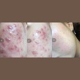 AHA/BHA Clarifying Treatment Toner